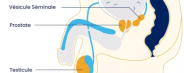 schéma de la prostate pour hypertrophie prostatique ou hypertrophie bénigne de la prostate