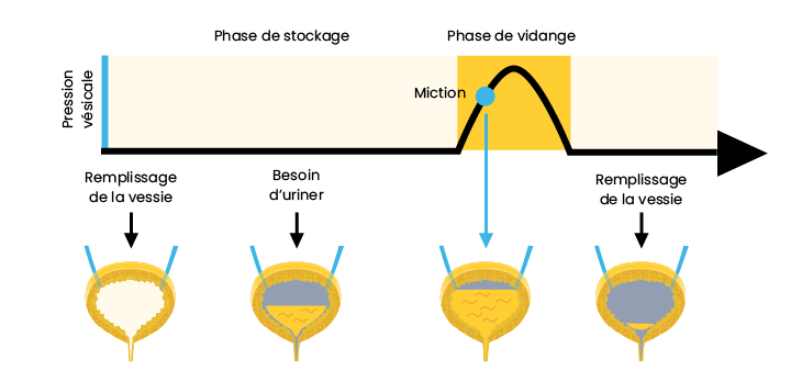 Le remplissage ou le stockage de l'urine